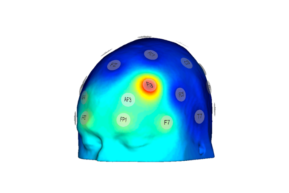 EEG Classification: Machine Learning Models and Tools for Brain Signal Analysis