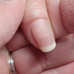 Gel Polish Removal