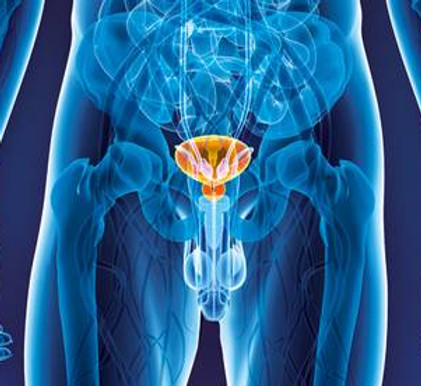 Prostatakrebs dendritische zelltherapie Immumedic