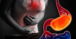 Fermented Soybean (FSB) Supplementation on GERD