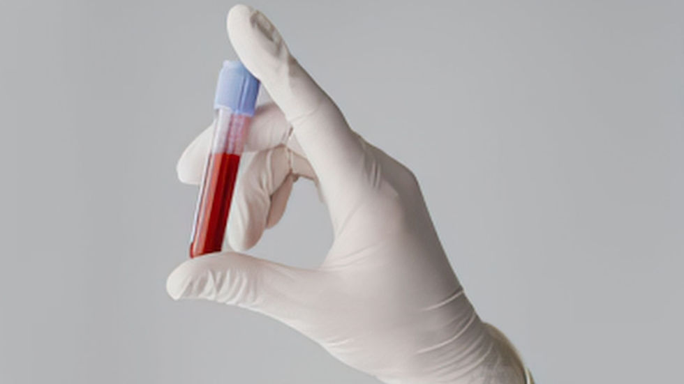 Lab test Nicci Parry