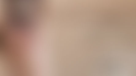 Bioestimuladores de Colágeno: O Segredo da Firmeza e Rejuvenescimento Natural da Pele