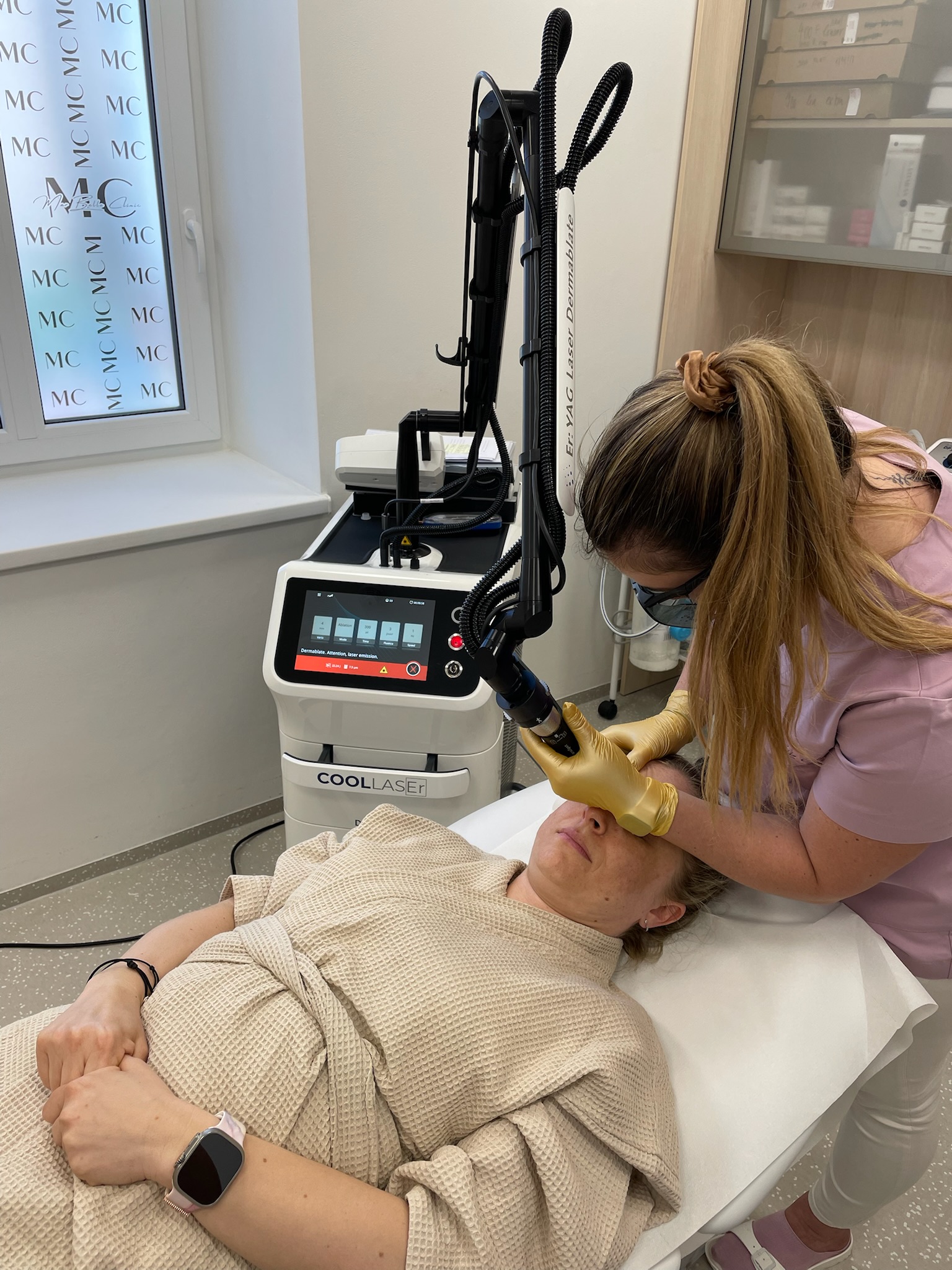 Asclepion Dermablate CoolLaser resurfacing