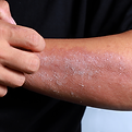 Dry-Sensitive-Itchy-Skin.png
