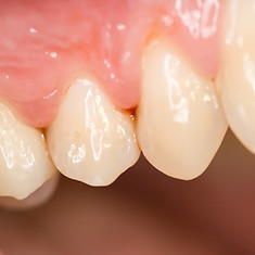 periodontia-peq.jpg