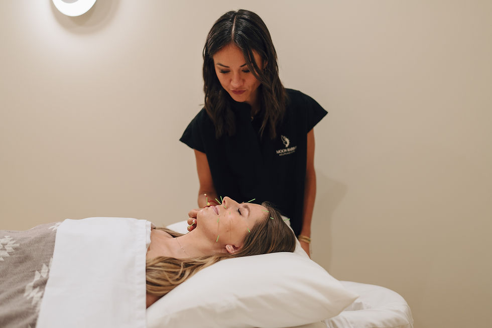 Why We Love Cosmetic Acupuncture Over Harsher Anti-Aging Treatments