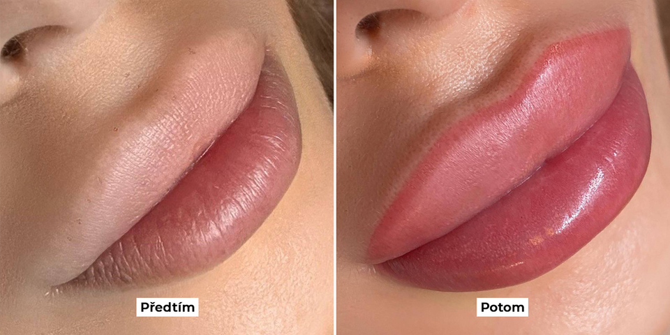 Kopie souboru Pred a po 5.png