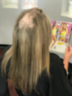 Bennetts & Jackson Hairdressing | Non-Surgical Hair Replacement | hair Loss