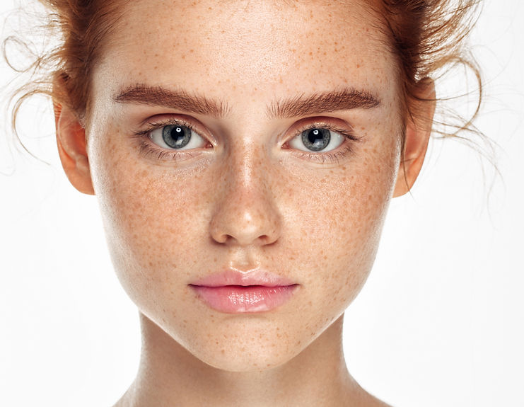 Polynucleotides skin regeneration treatment at Dermaline Aesthetics Berkhamsted showing natural skin rejuvenation results