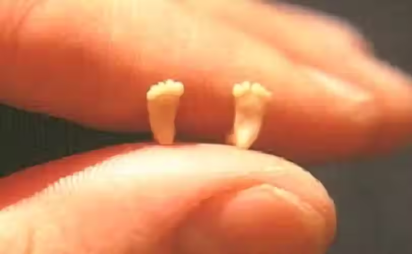 1970년 러셀 사코(Sacco) 의삭 낙태의 경각심을 알리기 위해 찍은 사진