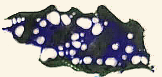 lace medium blue black.png
