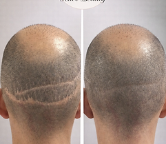 imagen personalizada-img-02-copyright-1536x1127.jpg