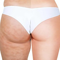 tratamiento-mesoterapia-corporal-e1650118919845.jpg