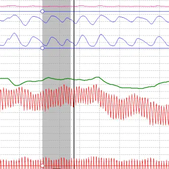 Polygraph Charts