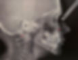  X-ray to accurately analyze a patient's orthodontic relationships 