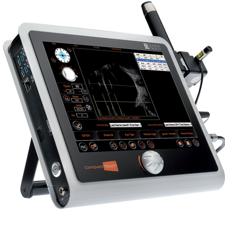 Ultrassom Ocular: Diagnóstico Preciso para Cuidar da Saúde dos Olhos