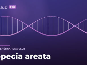 Alopecia areata
