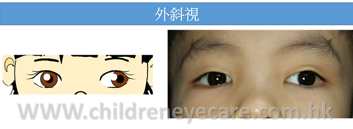 XT.png