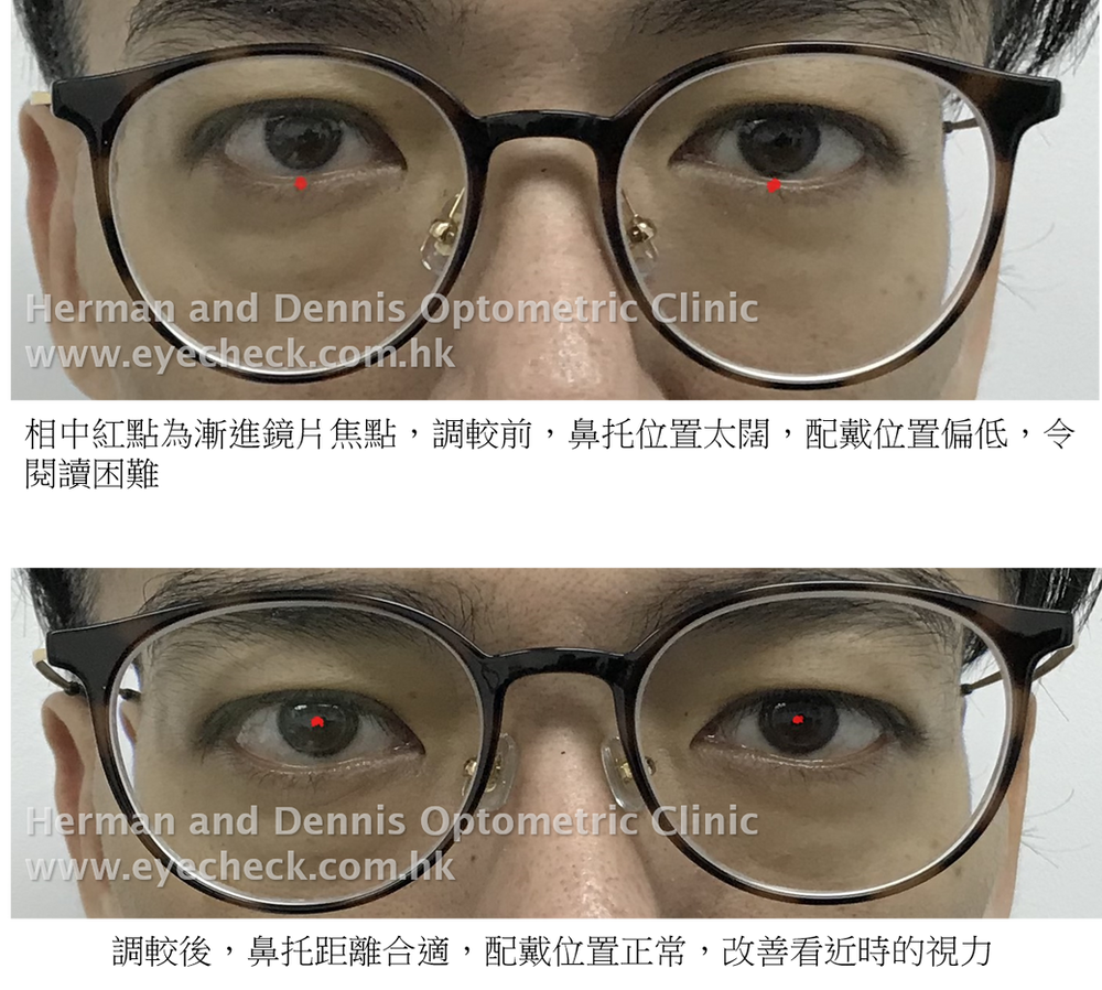 漸進眼鏡位置問題