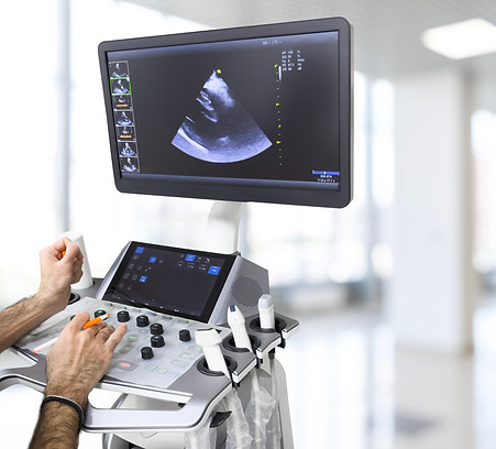 Ultrasound or sonogram procedure. Doctor hand holding an ultrasound. Ultrasound exam