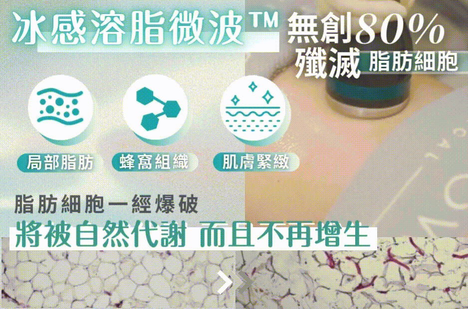 冰感溶脂微波™.gif