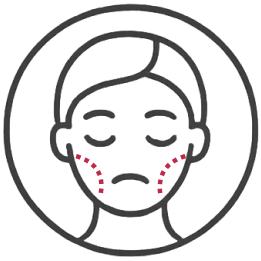 面中結構下陷.webp