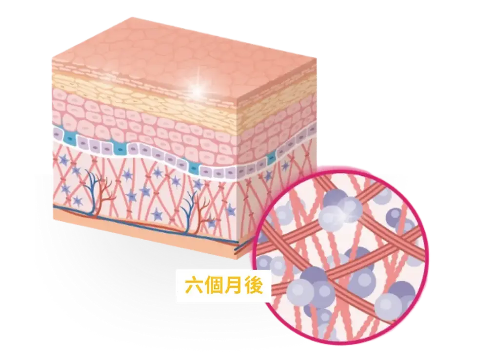 2.webp