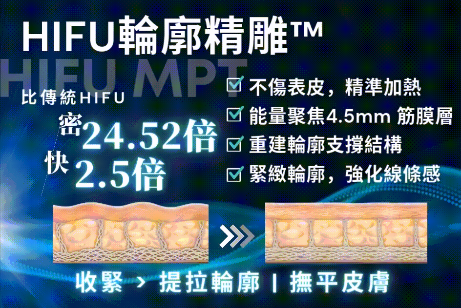 HIFU輪廓精雕™.gif