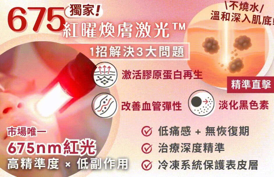 紅曜煥膚激光™.gif
