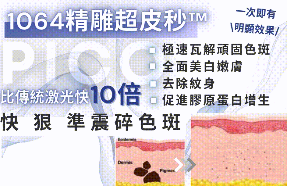 1064精雕超皮秒™.gif