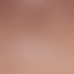 Síndrome do Nevo Displásico