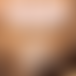 Maio Mês do Combate ao Melanoma