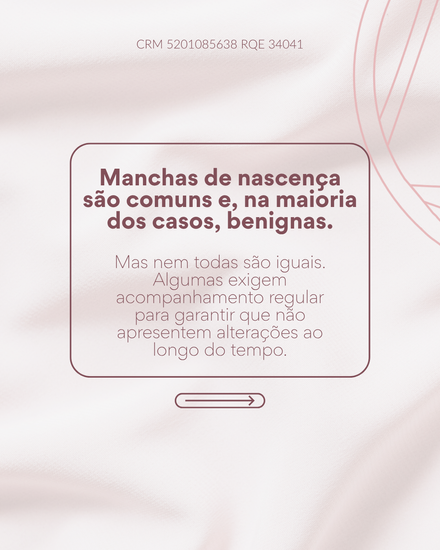 Manchas de nascença