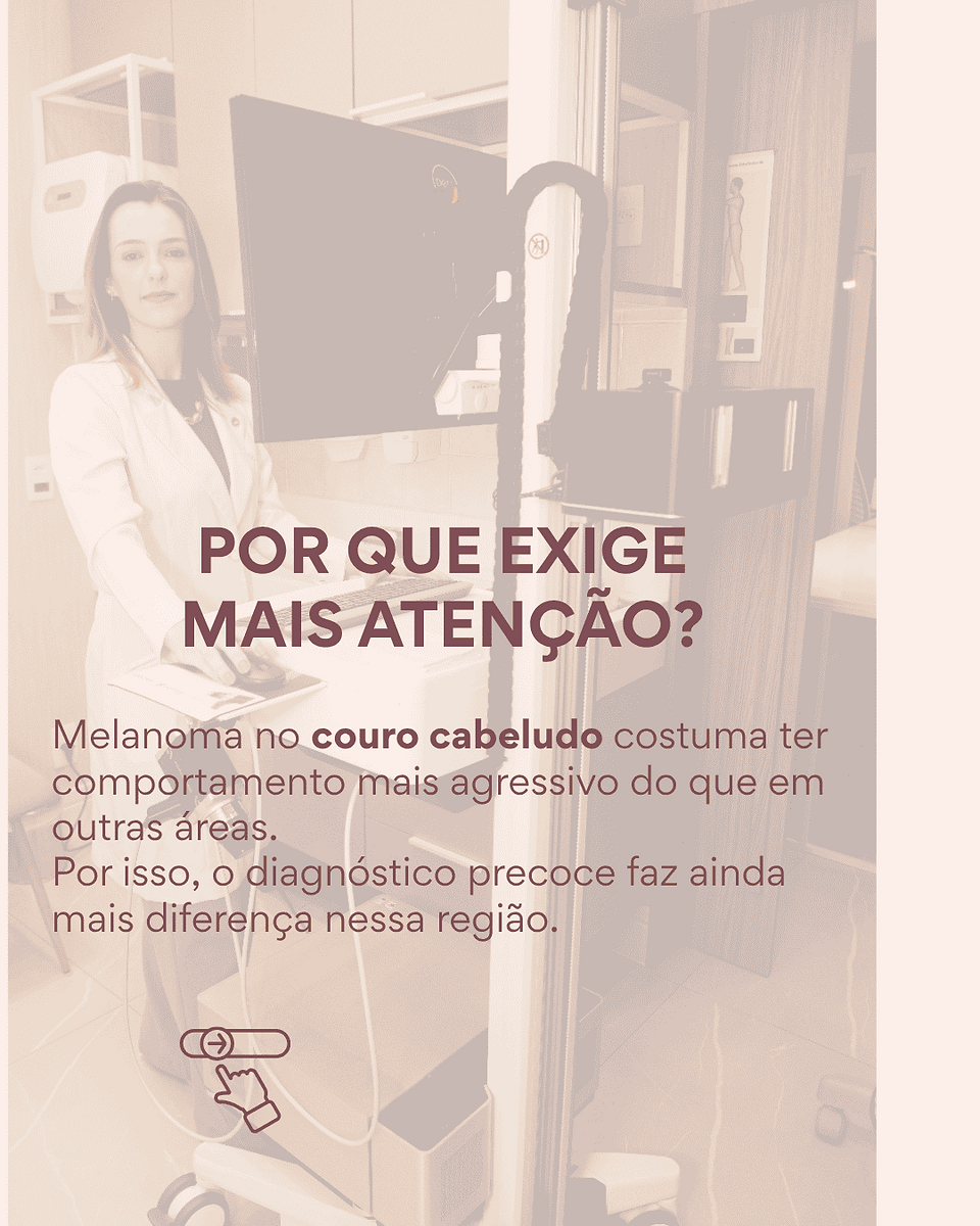 Melanoma no couro cabeludo