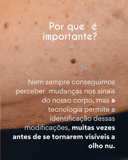 Monitoramento dos Sinais