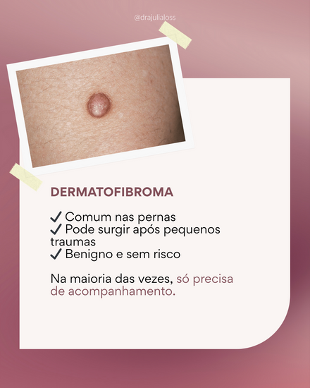 Lesões que assustam mas são benignas