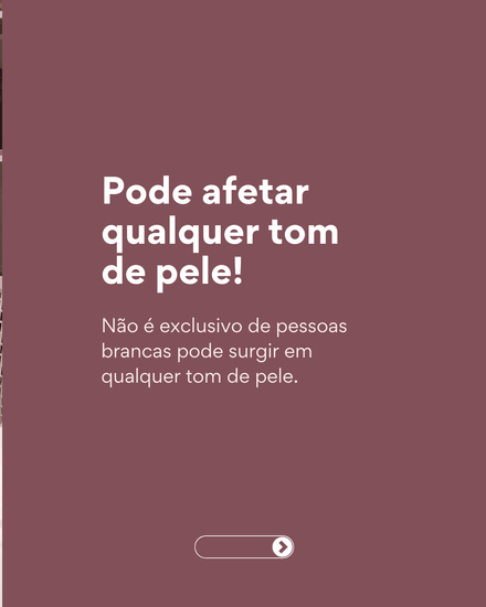 Fatos importantes sobre o câncer de pele 