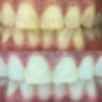 9B318107-3B0E-4C8E-BF40-6E09FC49DDC9