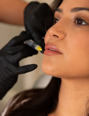 Tejas Beauty Dallas nurse injector performing lip filler treatment on client during aesthetic procedure