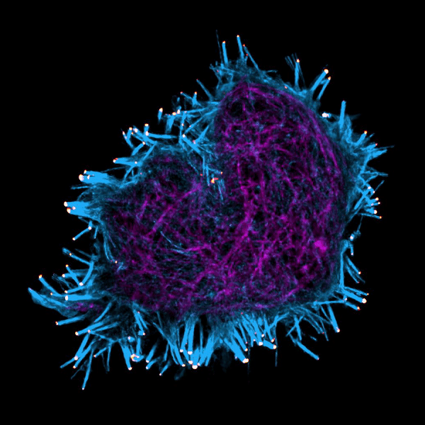 N2A cell filopodia