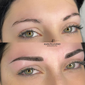 Centro di Estetica Avanzata Beauty Zone Acireale Agata Pellegrino Microblading Laser a Diodo Trucco Semipermanente Tricopigmentazione Rimozione Tatuaggio Corner Marzia Clinic Corpo Viso Menopausa Microneedling BB Glow