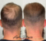 Tricopigmentazione Dermopigmentazione Trucco Semipermanente Beauty Zone Acireale Agata Pellegrino