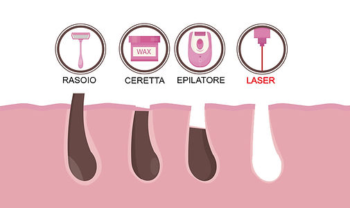 Centro di Estetica Avanzata Beauty Zone Acireale Agata Pellegrino Microblading Epilazione Laser a Diodo Mediostar Trucco Semipermanente Tricopigmentazione Rimozione Tatuaggio Corner Marzia Clinic Corpo Viso Menopausa Microneedling BB Glow