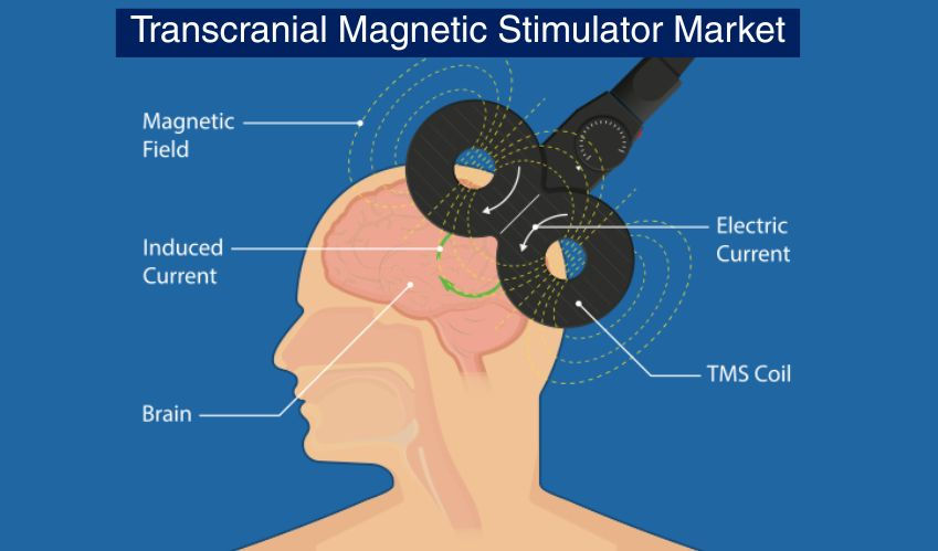 Transcranial Magnetic Stimulator Market Size 2026-2035