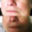 Smoother, more youthful, clearer skin ca