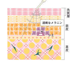 2019-FIVE-機能-肌断面-イオンスキン.jpg