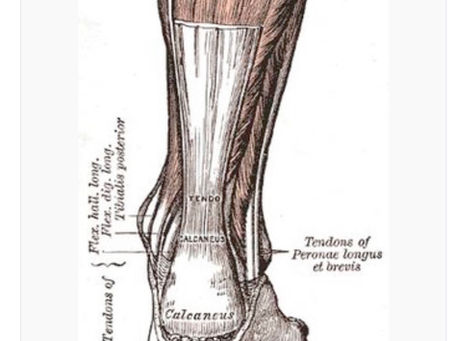 Tendonitis Treatment Appleton