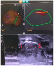The Artemis device imaging
