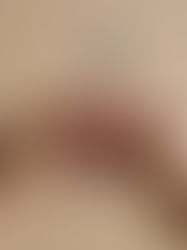 Epigenetic Clock: Youth in 6 Days, Cancer in 12 Days