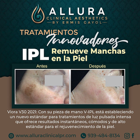 Fotorejuvenecimiento Ipl Beneficios Del Ipl Facial